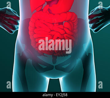 3d umani x-ray con dolore nella cavità addominale Foto Stock