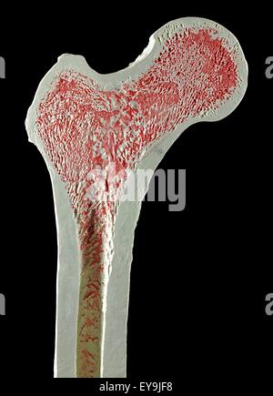 Sezione trasversale attraverso un modello di un normale destra superiore del femore gamba o osso. Foto Stock