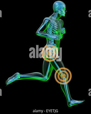 La radiografia di un corpo umano in atto di esecuzione con dolore anca e ginocchio Foto Stock