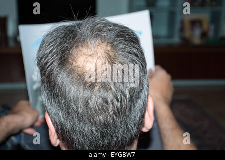 Uomo maturo, visto da dietro, nella testa, comincia a perdere i capelli, comincia ad essere vecchio. Foto Stock