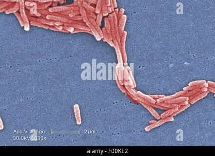 Colorati scanning electron microfotografia (SEM) rappresentato un raggruppamento sparsi di batteri Gram-negativi Legionella pneumophila batteri. Mag 8000X Foto Stock
