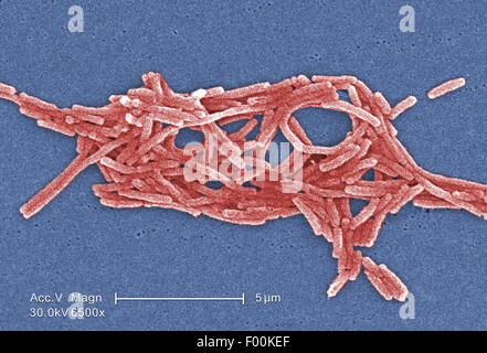 Colorati scanning electron microfotografia (SEM) rappresentato un raggruppamento di batteri Gram-negativi Legionella pneumophila batteri. Mag 6500X Foto Stock