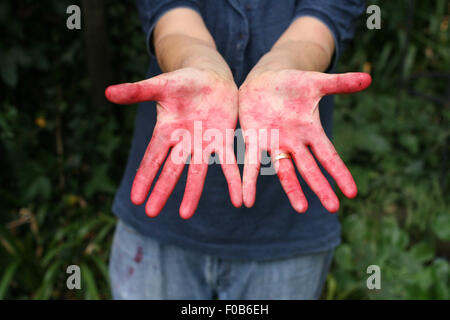La donna che mostra le mani macchiate da picking ripe gelsi, frutto del gelso, Morus nigra Foto Stock
