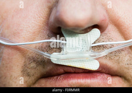 Un uomo di mezza età indossa polisonnografia apparecchiature per misurare l'attività cerebrale, la respirazione e il movimento durante il sonno. Foto Stock