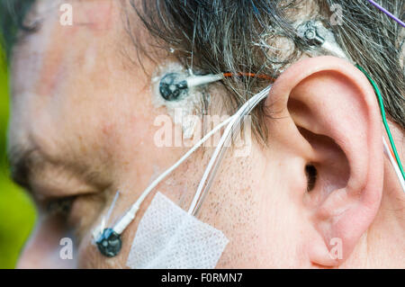 Un uomo di mezza età indossa gli elettrodi di polisonnografia per misurare l'attività cerebrale, la respirazione e il movimento durante il sonno. Foto Stock