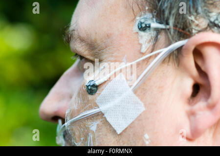 Un uomo di mezza età indossa gli elettrodi di polisonnografia per misurare l'attività cerebrale, la respirazione e il movimento durante il sonno. Foto Stock