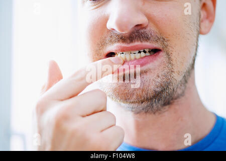 Uomo con il mal di denti Foto Stock