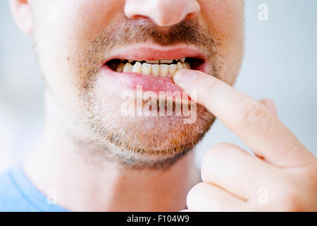 Uomo con il mal di denti Foto Stock