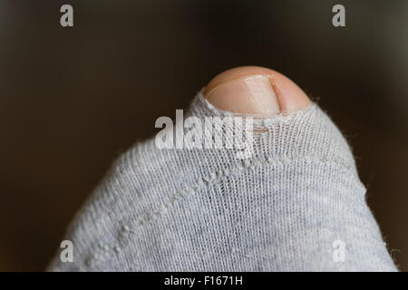 L'alluce del piede sinistro proveniente attraverso un piccolo foro in una calza strappato realizzato in cotone grigio Foto Stock