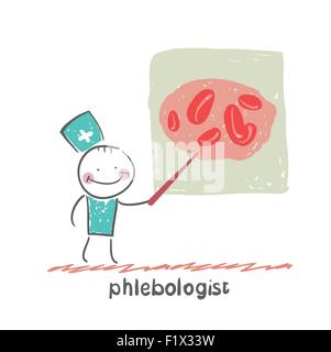 Phlebologist. Divertimento in stile fumetto illustrazione. La situazione di vita. Illustrazione Vettoriale