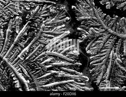 La complessità di umana tristezza lacrima imaging in un microscopio elettronico a scansione Foto Stock