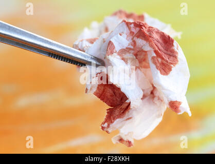 Il sangue nel tessuto di carta con un forcipe Foto Stock