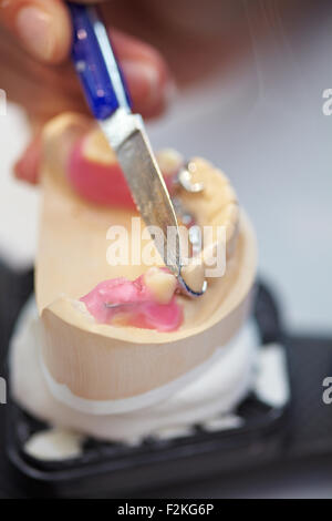 Lavoro su dentiere con cera da modellazione in un laboratorio odontotecnico Foto Stock