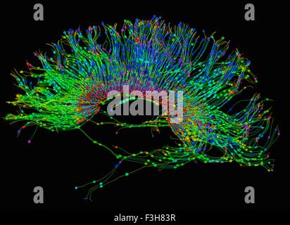 La diffusione MRI, a cui si fa riferimento anche come imaging del tensore di diffusione o DTI, del cervello umano Foto Stock