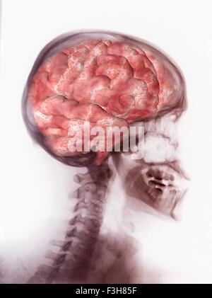 Illustrazione del cervello umano sovrapposto su di un x-ray del cranio Foto Stock