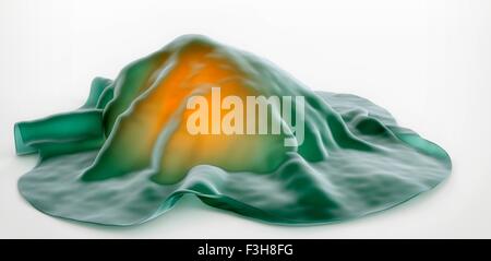 3D illustrazione di un altamente invasive di cellule tumorali Foto Stock