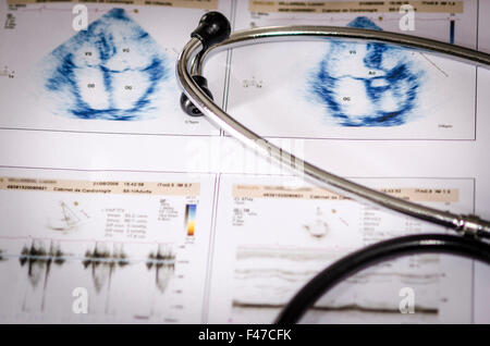 CARDIOLOGIA Foto Stock