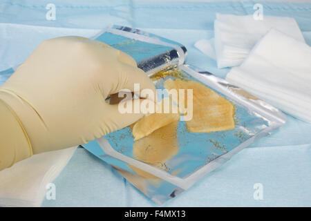 Seleziona infermiere sterile medicazione di idrogel per uso su una bruciatura o ferita. Foto Stock