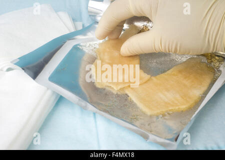 Seleziona infermiere sterile medicazione di idrogel per uso su una bruciatura o ferita. Foto Stock