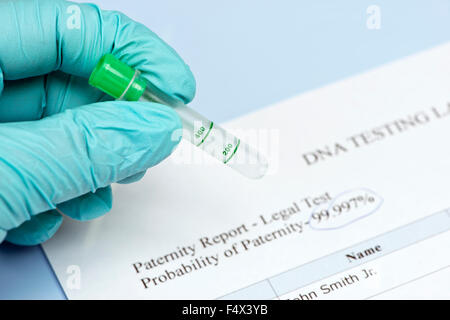 Tecnico di laboratorio detiene il tubo di coltura con DNA testing lab relazione. Foto Stock