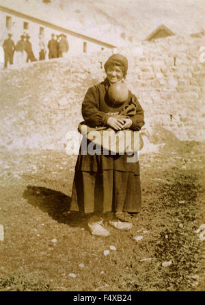 Una contadina con un enorme ciste Foto Stock