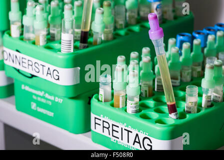 Ampullas contenente sangue esaminati campioni di coagulazione sono archivated nel rack di verde Foto Stock