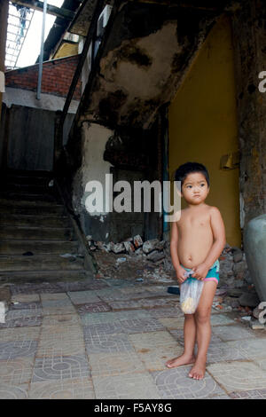 Una giovane ragazza che di recente ha subito in neurochirurgia presso la clinica Bopha sorge nei pressi di una rampa di scale nella sua casa di Kampong Cham, Cambogia. Foto Stock