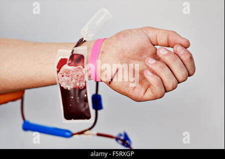 Dettaglio con la mano di un donatore di sangue e una plastica sacca di sangue in un ospedale Foto Stock