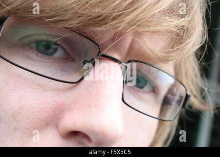 Frustrati / interessati / occhi stanchi close up di un giovane uomo con occhiali Foto Stock