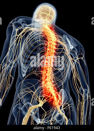 Dal punto di vista medico illustrazione accurata - dolorosa spina dorsale Foto Stock