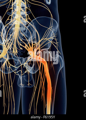 Dal punto di vista medico illustrazione accurata - dolorosa del nervo sciatico Foto Stock