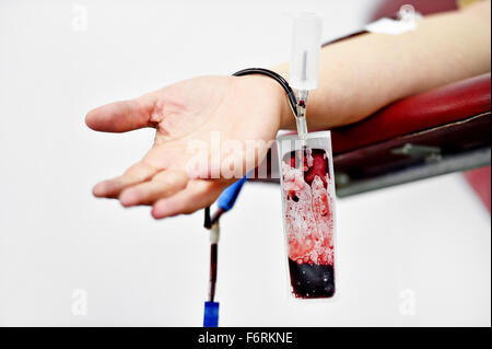 Dettaglio con la mano di un donatore di sangue e una plastica sacca di sangue in un ospedale Foto Stock