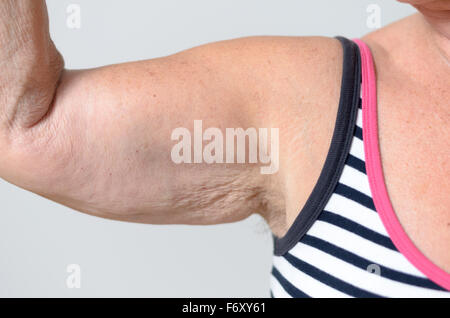 Chiudere fino ai muscoli delle braccia e ascelle di una donna di mezza età in Casual Camicia senza maniche, isolata su uno sfondo grigio. Foto Stock
