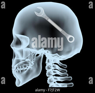 Raggi X di una testa con la chiave al posto del cervello, 3d illustrazione Foto Stock