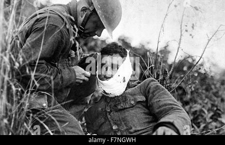 Fotografia di un ferito soldato americano, ricevendo cure di pronto soccorso durante la Prima Guerra Mondiale. Datata 1918 Foto Stock