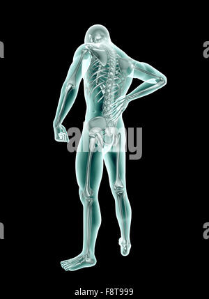 Immagine a raggi x di un uomo con il mal di schiena su nero con tracciato di ritaglio . Foto Stock