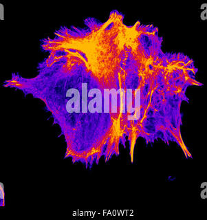 Un campione biologico di cellule e batteri, pianta microb sotto microscopia Foto Stock