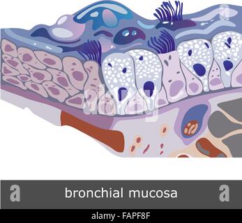 Struttura del danneggiato nella mucosa bronchiale con sputo, illustrazione vettoriale Illustrazione Vettoriale