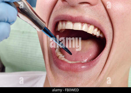 Dentista esamina la bocca del paziente, close up Foto Stock