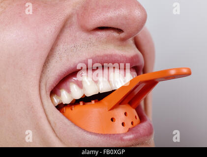 Inserti di dentista lama nella bocca del paziente per impressione tenendo Foto Stock