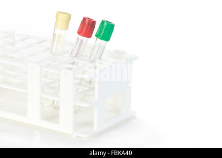 Un assortimento di provette per la raccolta di sangue in rack con copia spazio. Foto Stock