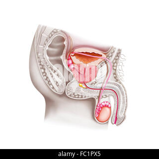 ADENOMA DELLA PROSTATA Foto Stock