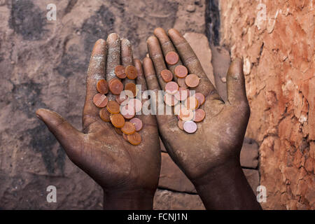 Dacca, Dhaka, Bangladesh. Decimo Dec, 2015. 18 gennaio 2016, Dhaka Bangladesh - un lavoro mostra il suo earing coin in una mattonaia ricoperti di polvere densa. In questo mattonaia bruciare il carbone provoca enorme produzione di Carbon-Di-ossido (CO2), il gas che è principalmente responsabile per il cambiamento climatico. Accanto a questa condizione di lavoro è talmente impolverata che uno non può respirare correttamente senza maschera. Circa 11.000 brickfields sono stabiliti in tutto il Bangladesh per soddisfare la crescente domanda di costruzione di opere di urbanizzazione come aumenta rapidamente nel paese. © K M Asad/ZUMA filo/Alamy Live News Foto Stock