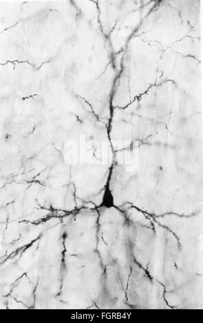 Medicina, anatomia, cerebrico / cranio, cortici del cerebrio umano, cellule piramidali, 20 ° secolo, 20 ° secolo, microscopia, cellula nervosa, cellule nervose, neurale, neuritico, percorso nervoso, tratto nervoso, vie nervose, tratti nervosi, corteccia cerebrale, cellule piramidali, medicina, farmaci, storico, diritti aggiuntivi-clearance-non disponibili Foto Stock