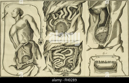 Istituzioni de chirurgie, oC3B9, L'su traite dans un ordre clair et nouveau de tout ce qui a rapport un cet arte - ouvrage de prC3A8s de quarante ans, OrnC3A9 d'onu grand nombre de figure en taille-douce, qui Foto Stock