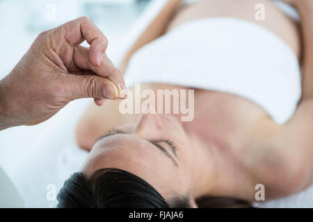 Donna incinta in una terapia di agopuntura Foto Stock