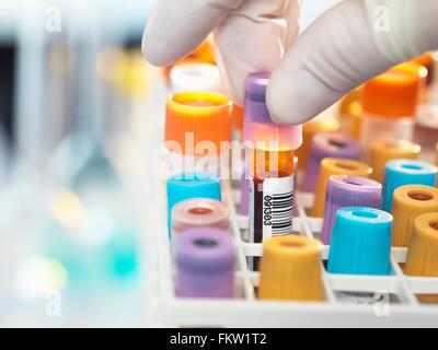 Tecnico di laboratorio di preparazione di campioni di sangue per il test medici in laboratorio Foto Stock