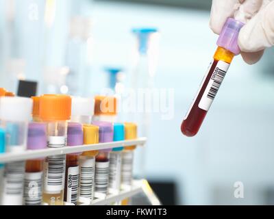 Tecnico di laboratorio di preparazione di campioni di sangue per il test medici in laboratorio Foto Stock