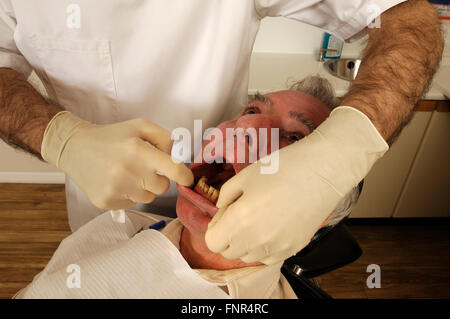 Un dentista esaminando un uomo anziano i denti e le gengive. Foto Stock