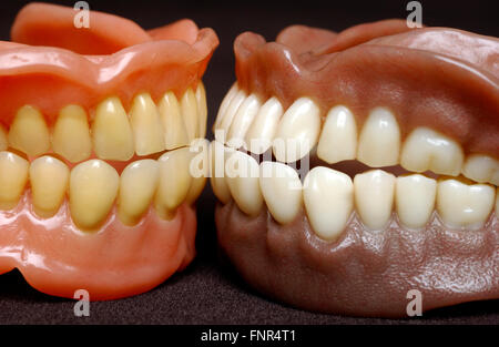 Due serie di protesi completa. Protesi o falsi denti sono realizzati a partire da una base in acrilico su cui acrilici o ceramica. Foto Stock